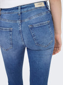 ONLBLUSH LIFE MIDSK ANKRAW REA 12187 NOOS 15195681